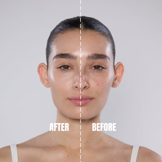 איך לשמור על עור בריא במזג האוויר הישראלי?